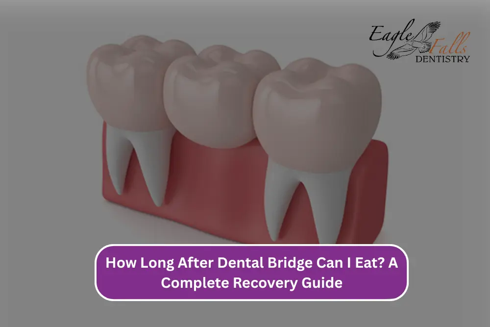 How Long After Dental Bridge Can I Eat Complete Recovery Guide