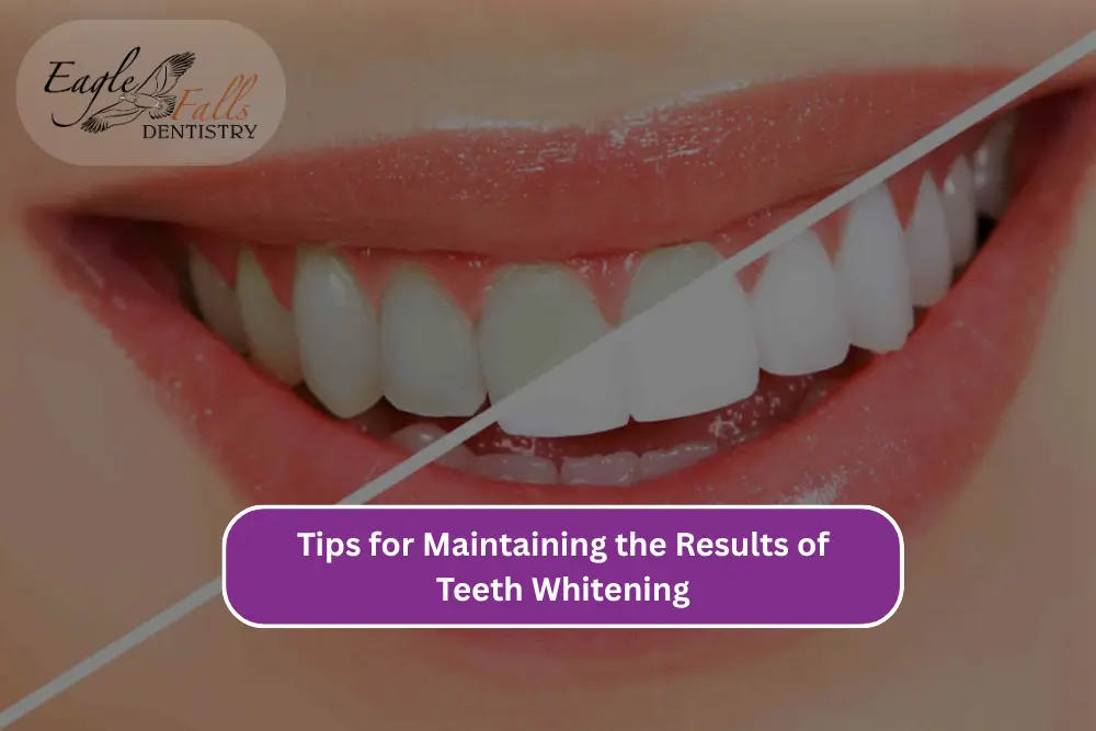 Tips for Maintaining the Results of Teeth Whitening