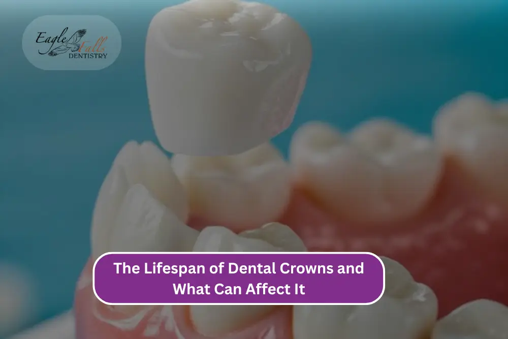 The Lifespan of Dental Crowns