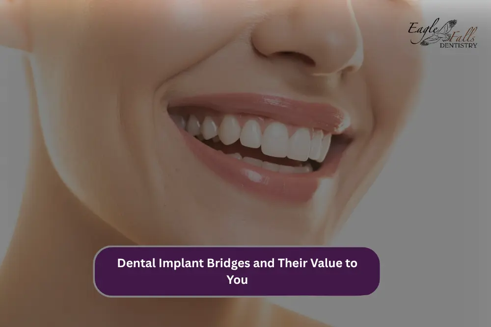 Close-up of a smiling person showing natural-looking teeth for dental implant bridge treatment